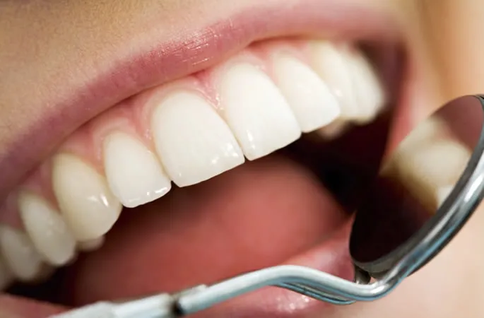 Revisión dental de cerca con espejo intraoral sobre los dientes y las encías
